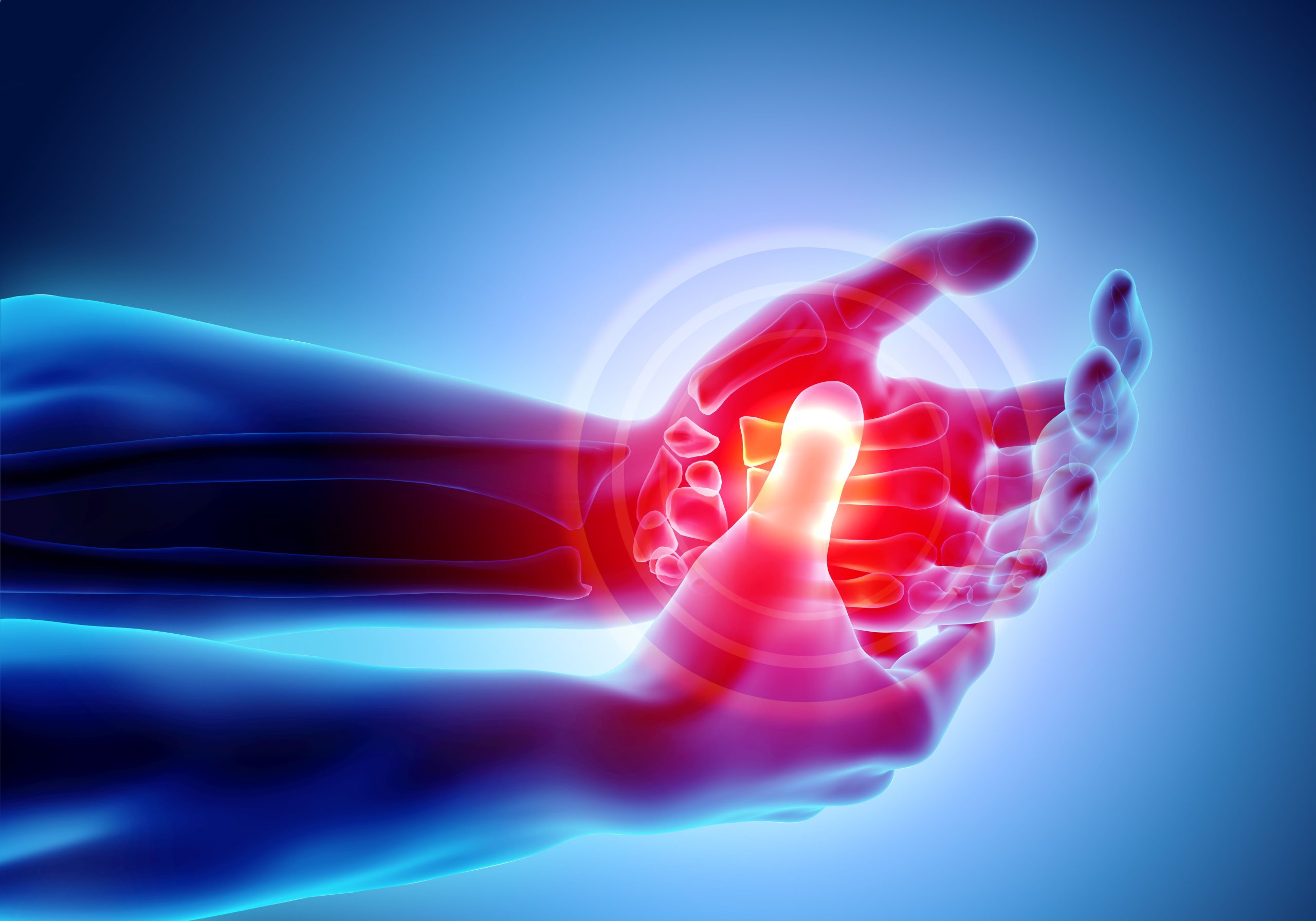 Study: High Similarity, Efficacy Between Tocilizumab Biosimilar and Reference Product in RA