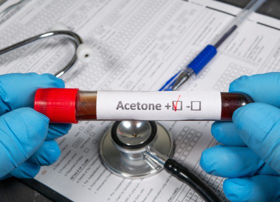 a-high-performance-room-temperature-acetone-gas-sensor-could-aid-diabetes-detection