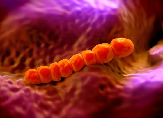 pneumococcal-positivity-associated-with-more-severe-covid-19-outcomes