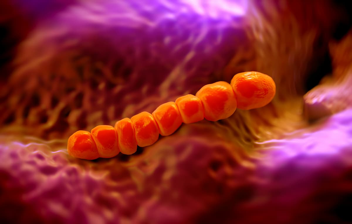 Pneumococcal Positivity Associated With More Severe COVID-19 Outcomes