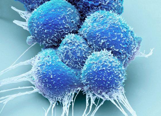 fda-approves-3-month-leuprolide-mesylate-21-mg-formulation-for-advanced-prostate-cancer