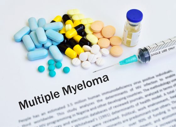 multiple-myeloma:-key-insights-on-diagnosis-and-evolving-treatment-strategies