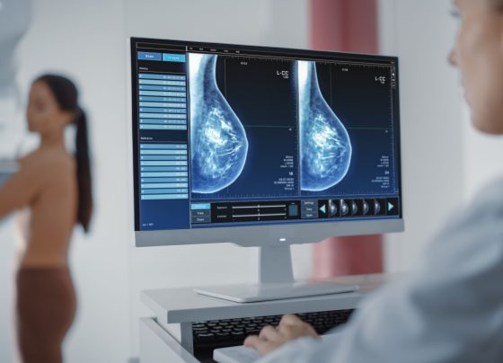 abemaciclib-plus-endocrine-therapy-improves-overall-survival-in-high-risk-early-breast-cancer