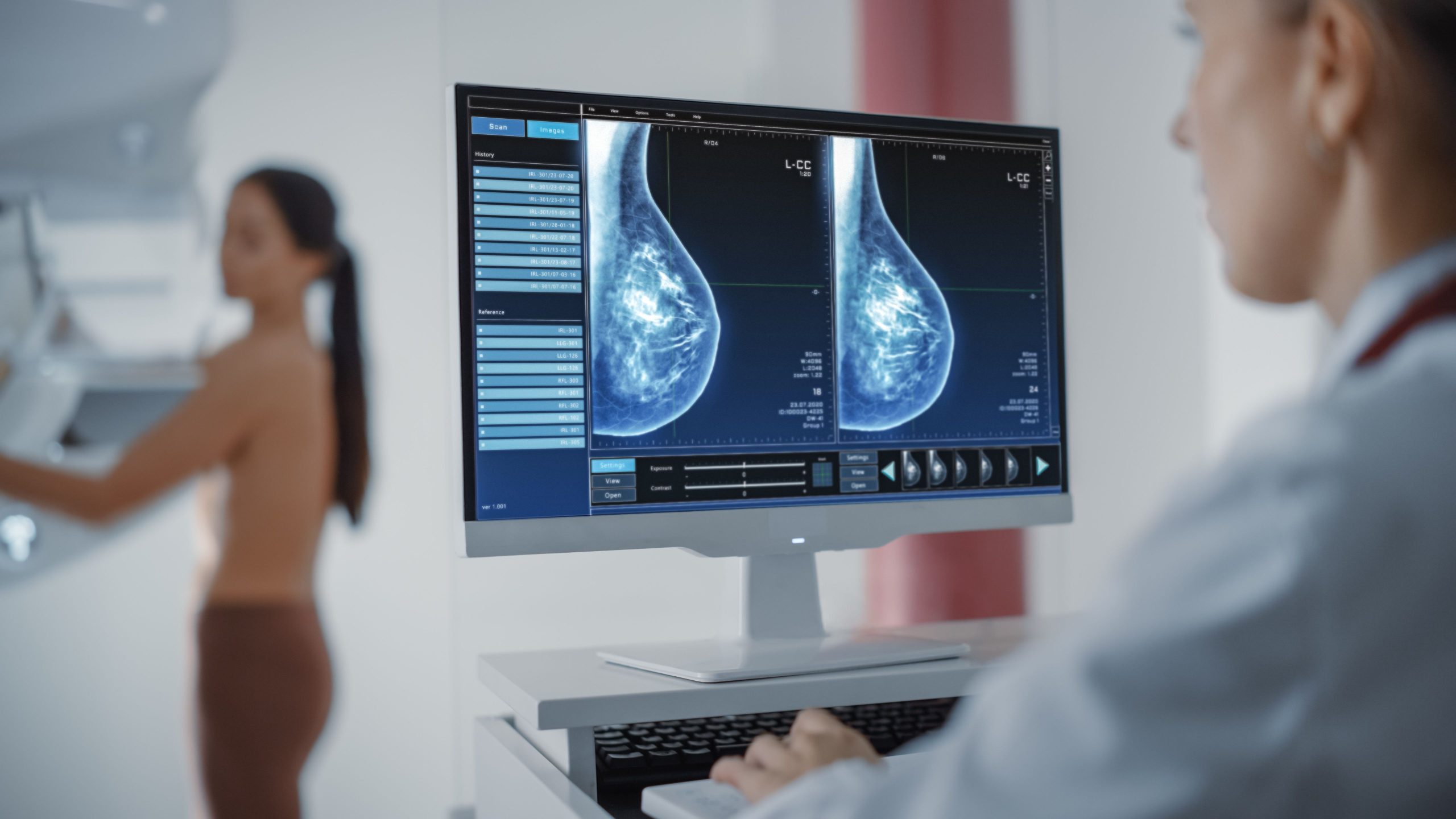 Abemaciclib Plus Endocrine Therapy Improves Overall Survival in High-Risk Early Breast Cancer
