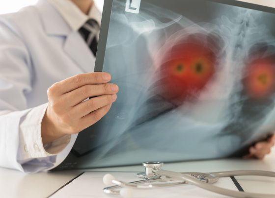 fda-grants-breakthrough-therapy-designation-to-olomorasib-with-pembrolizumab-for-nsclc