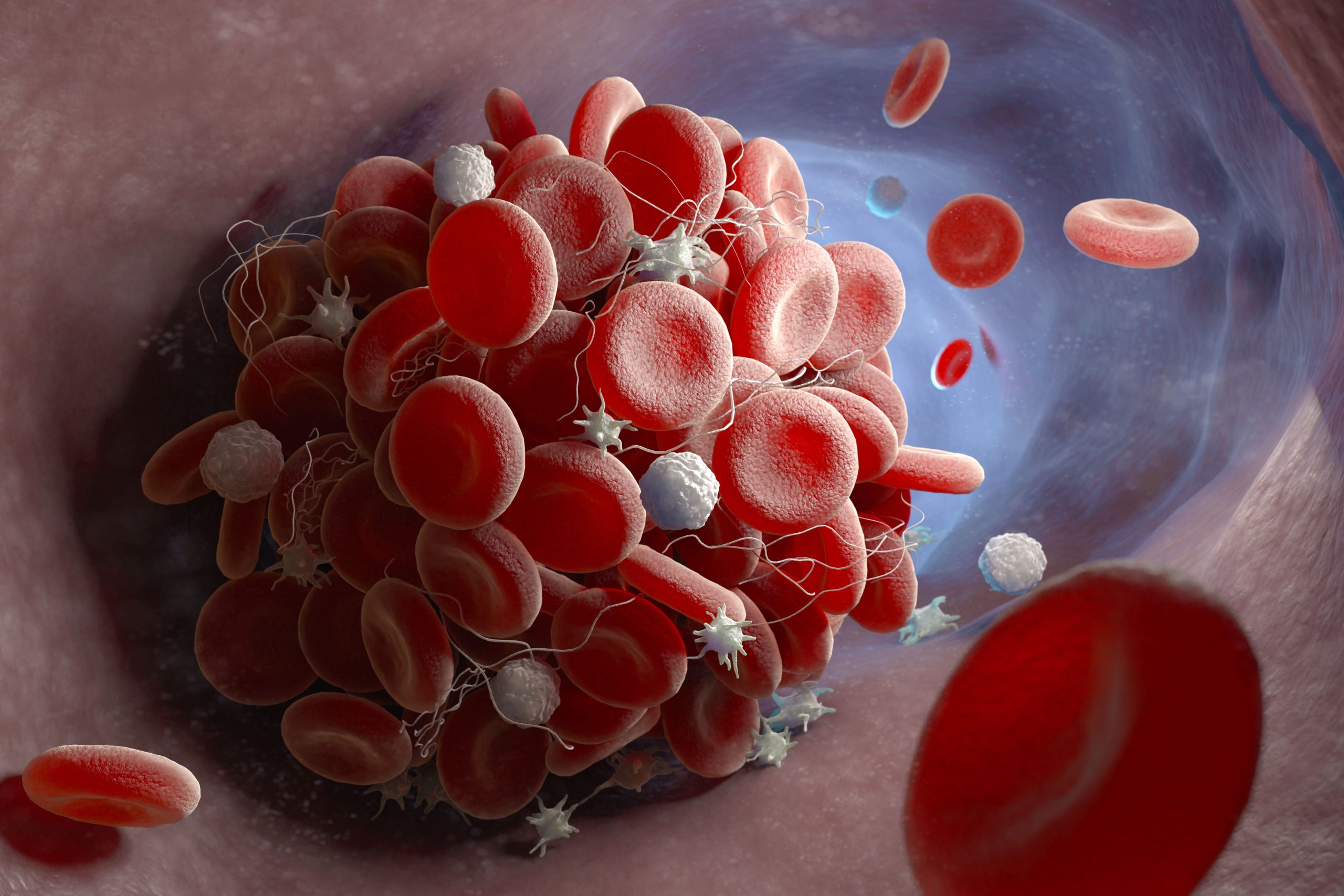 FDA Approves Expanded Use of Vonvendi for VWD in Adults and Children