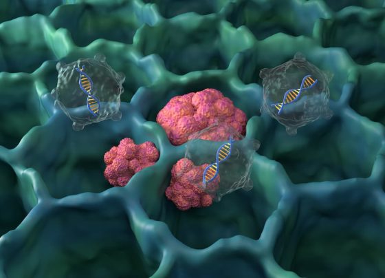 expert:-zongertinib-offers-well-tolerated,-convenient-oral-option-for-her2-mutant-nsclc