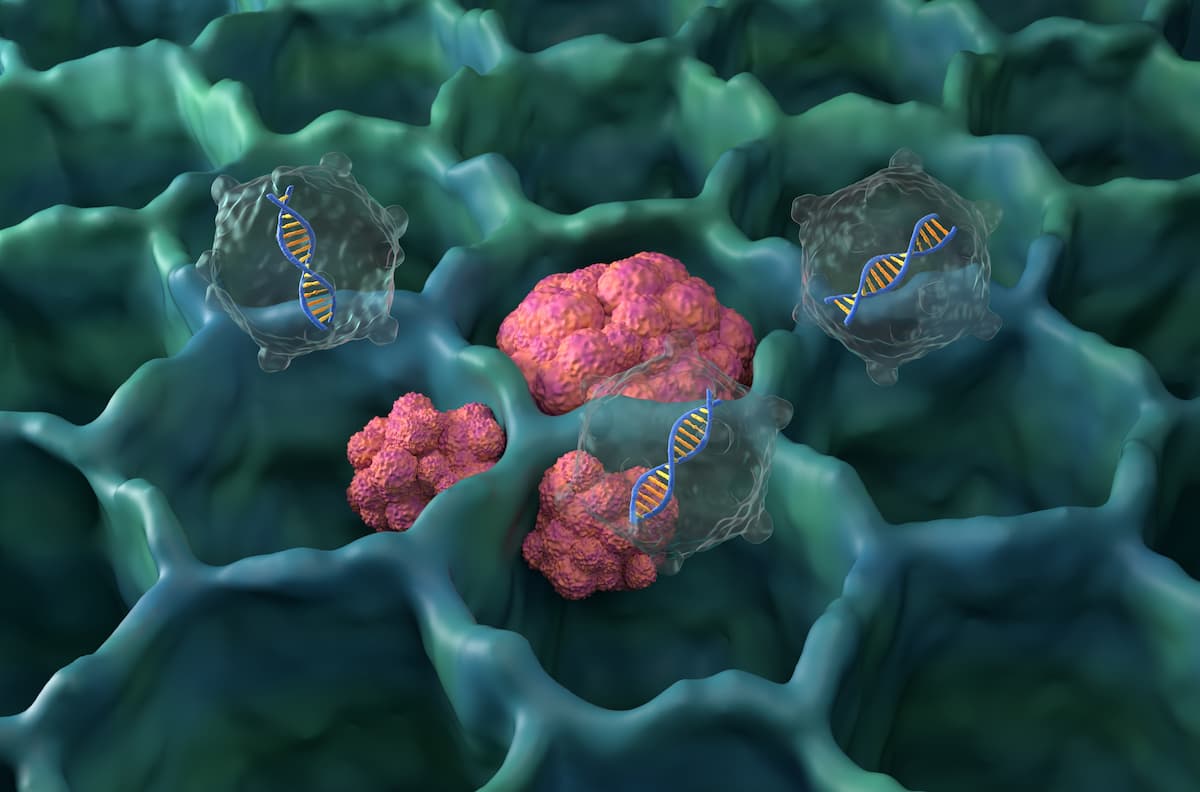 Expert: Zongertinib Offers Well-Tolerated, Convenient Oral Option for HER2-Mutant NSCLC