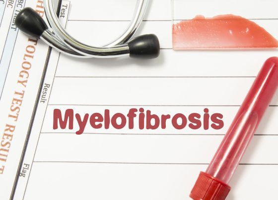balancing-efficacy-and-safety:-navigating-dose-adjustments-and-therapy-optimization-in-myelofibrosis