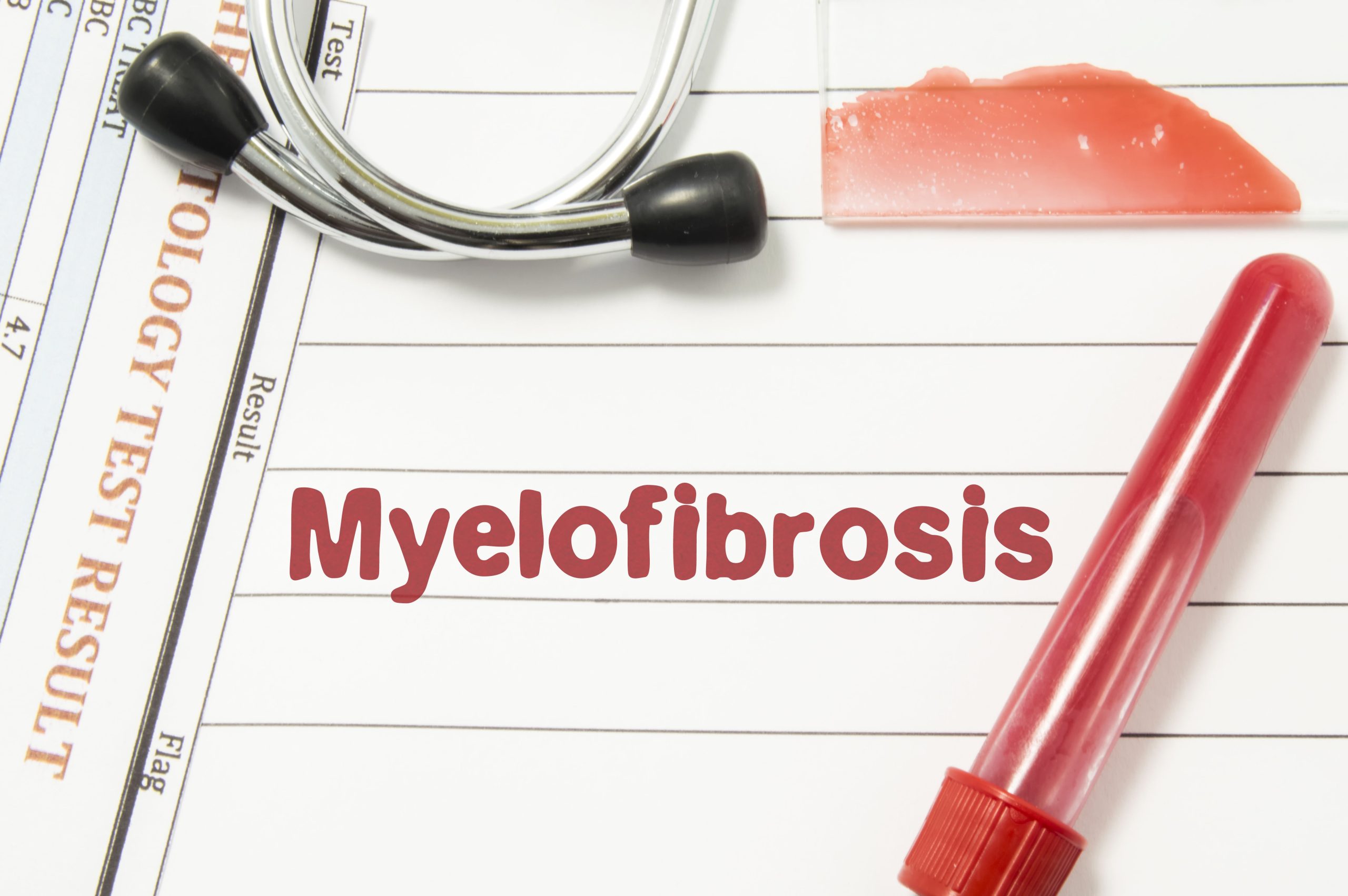 Balancing Efficacy and Safety: Navigating Dose Adjustments and Therapy Optimization in Myelofibrosis
