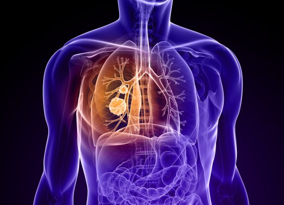 zidesamtinib-shows-clinically-meaningful-activity,-durability-in-ros1+-nsclc