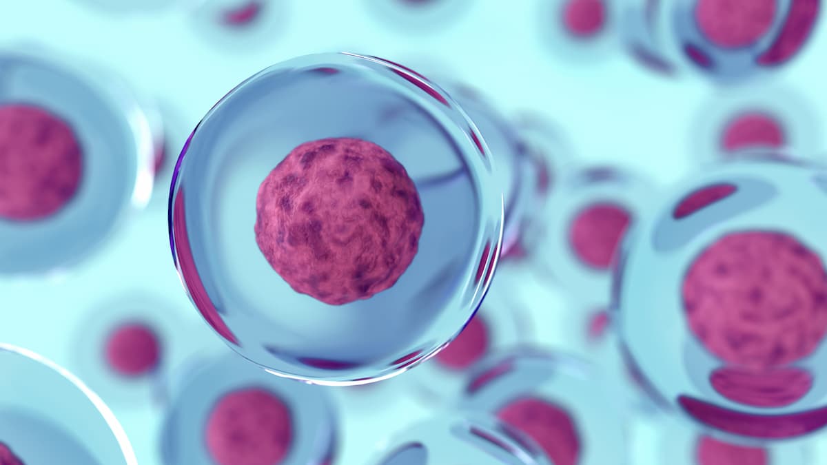 Novel Conditioning Strategies Emerge in Gene Therapy, Leaving Busulfan—And Toxicities—Behind