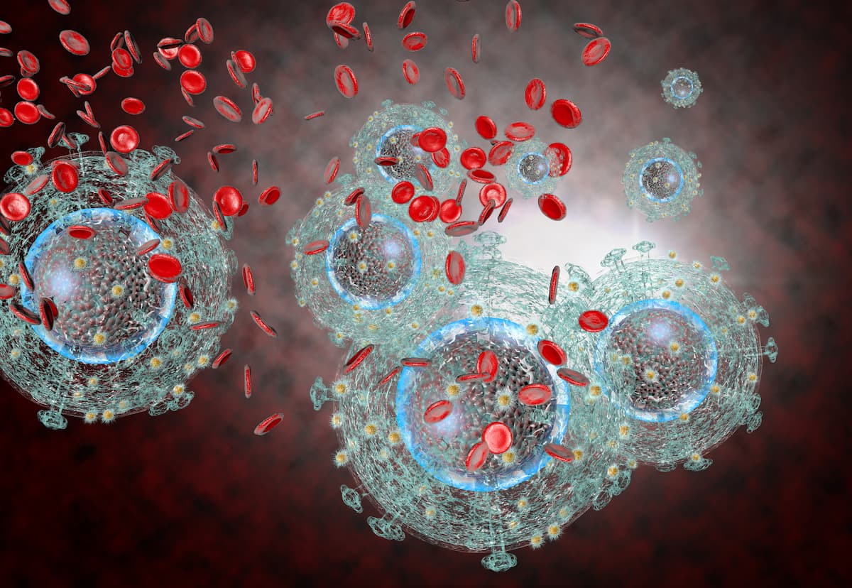 <![CDATA[Pneumococcal 21-Valent Vaccine Well-Tolerated, Immunogenic in Patients Living With HIV]]>