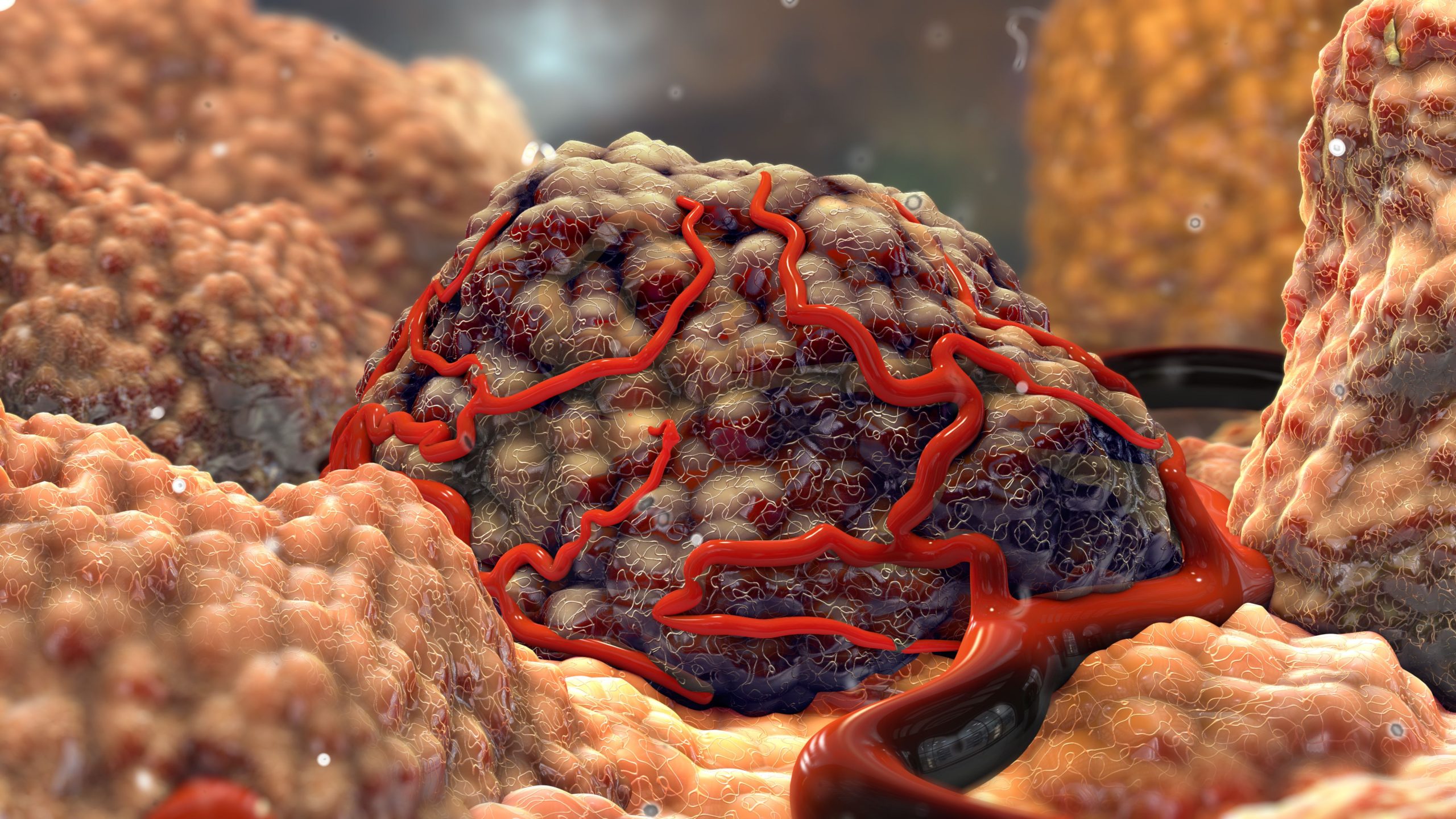 <![CDATA[Expert Q&A: Navigating the Evolving Landscape of Solid Tumor Therapies]]>