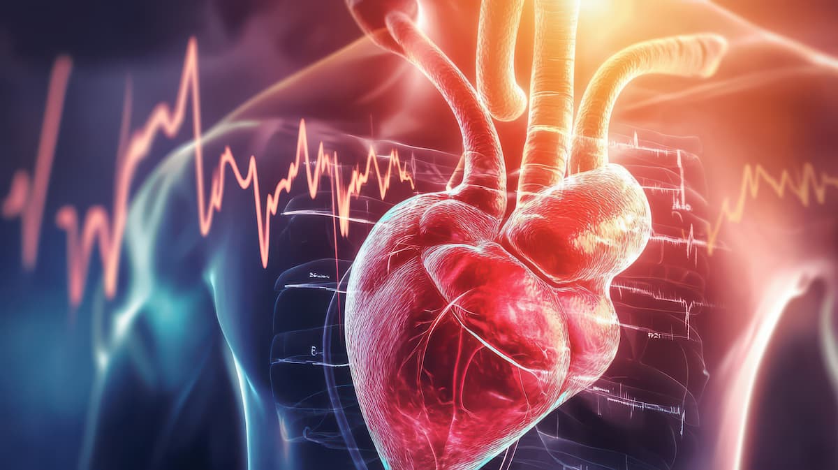 <![CDATA[Delayed Statin Initiation Following Detection of High LDL-C Raises Risk of Heart Attack]]>