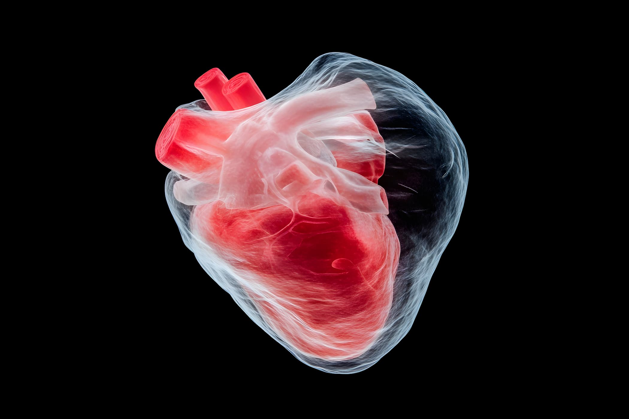 <![CDATA[Vutrisiran Demonstrates Low Rates of Gastrointestinal Events in Patients With ATTR-CM]]>