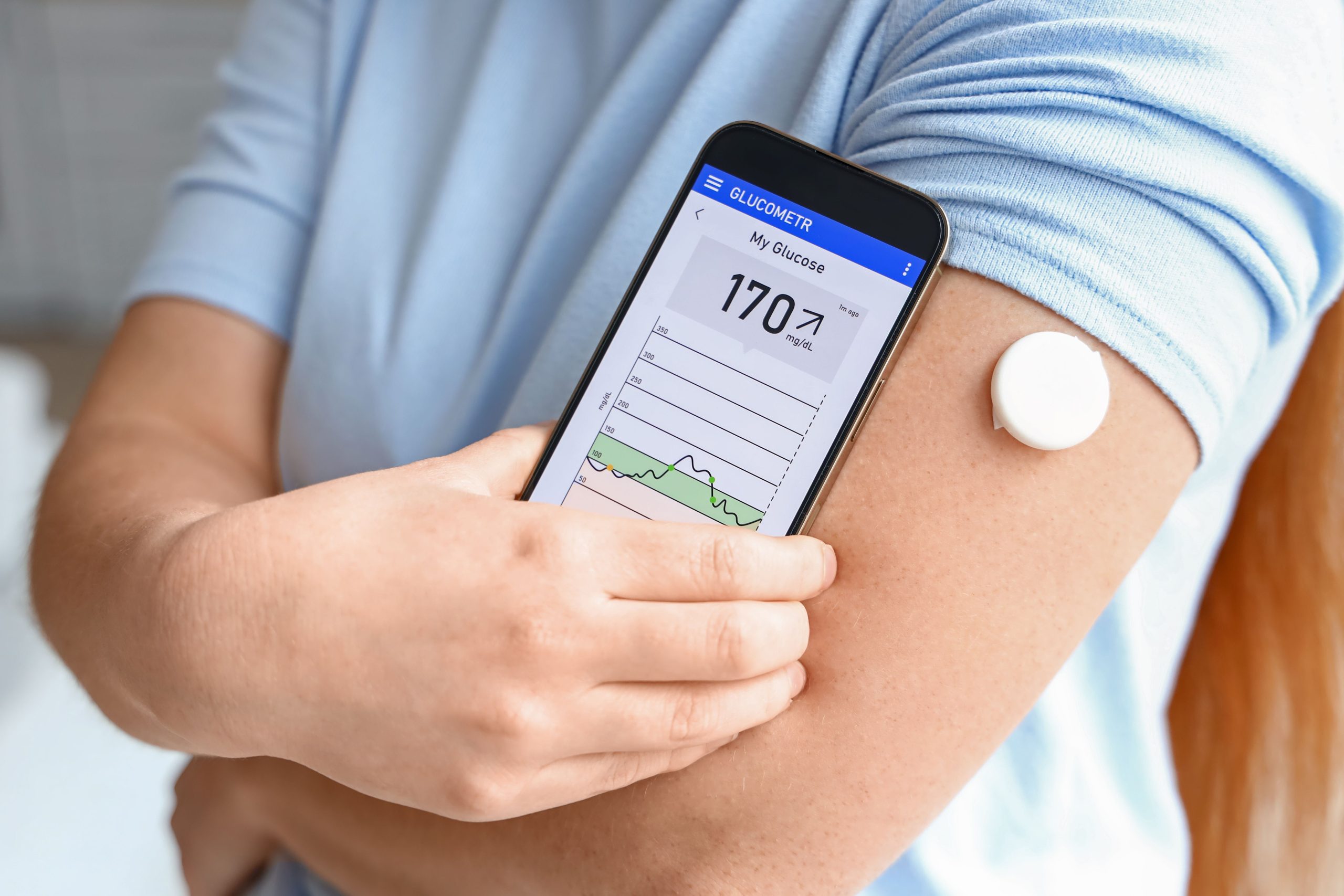 <![CDATA[Study Finds CGMs Could Overestimate Food’s Impact on Blood Sugar Among Nondiabetic Individuals ]]>