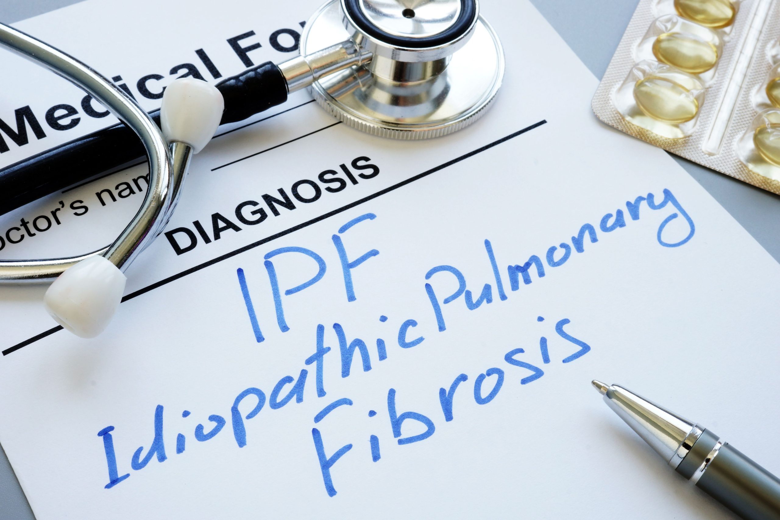 <![CDATA[Nerandomilast Receives FDA Approval for Idiopathic Pulmonary Fibrosis]]>
