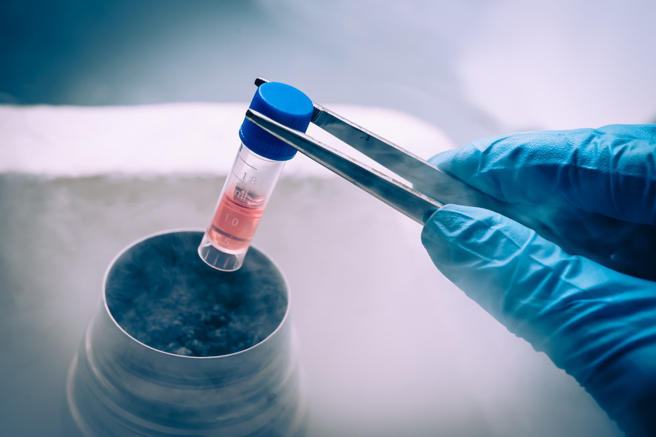 <![CDATA[Cholesterol Levels Not Associated With Blood Stem Cell Mobilization in Healthy Donors]]>