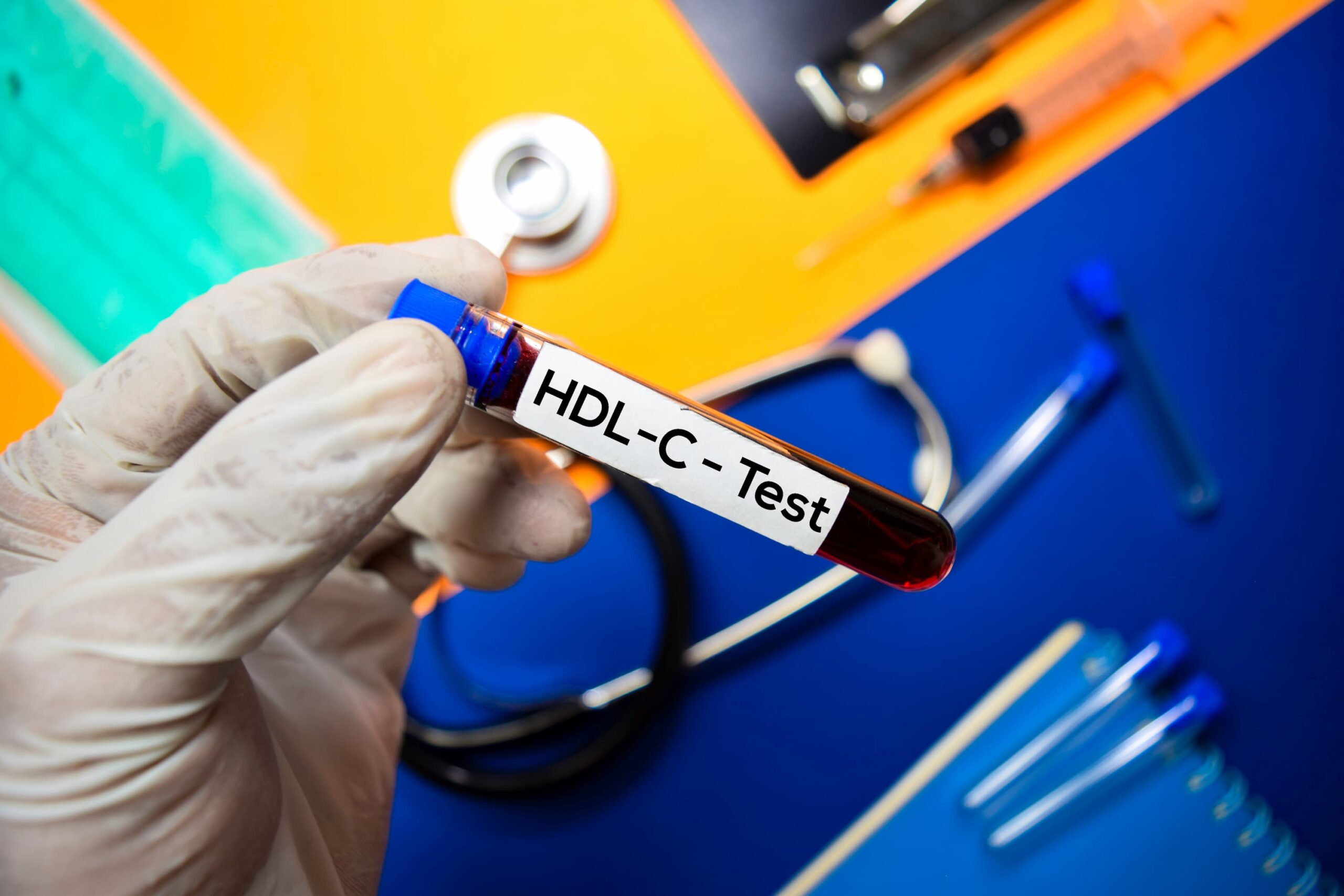 <![CDATA[HDL-C-to-LDL-C Ratio Can Predict Prognosis of High-Risk CVD Individuals]]>