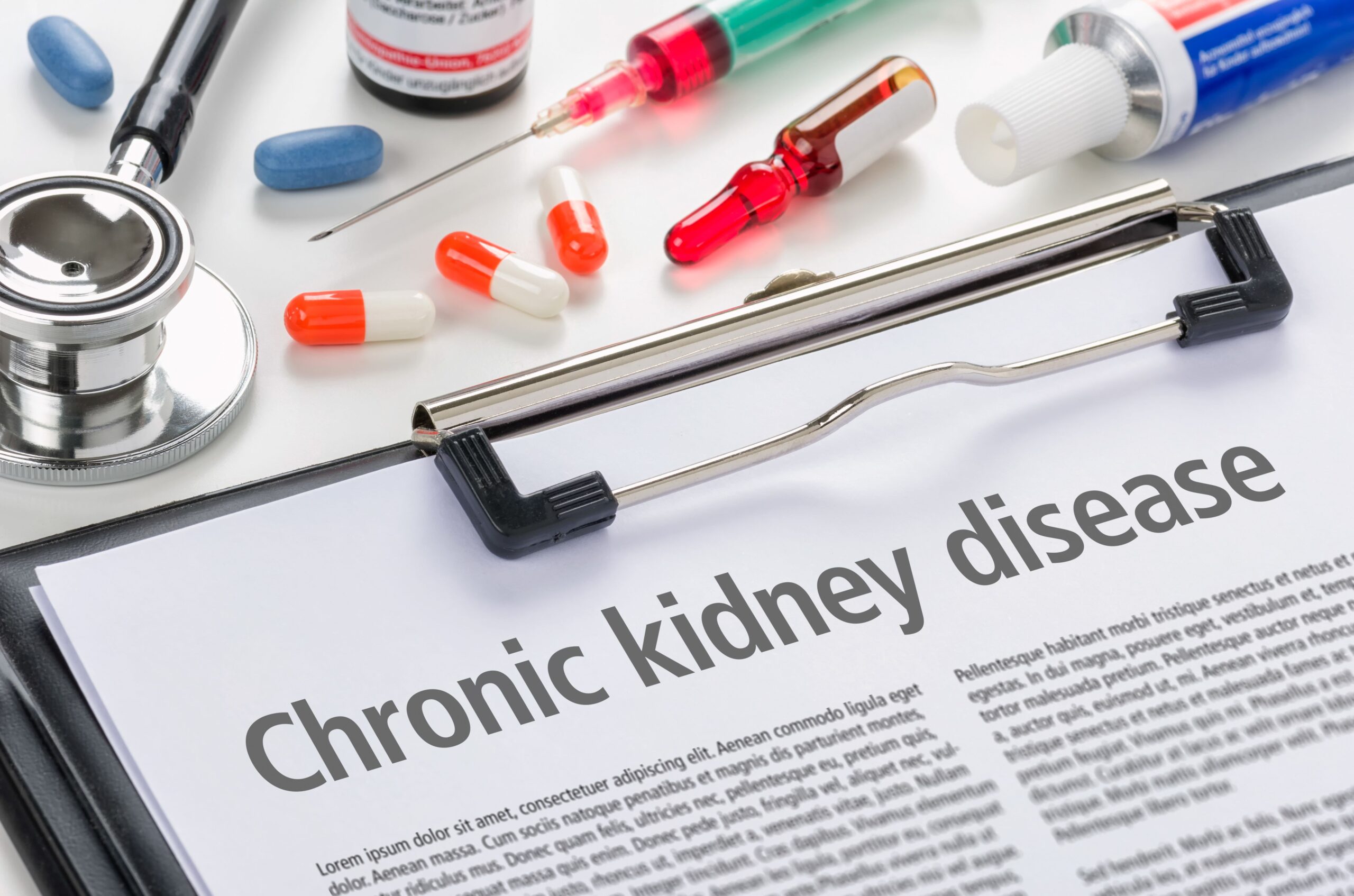 <![CDATA[Study: APOL1 Mutations in CKD Significantly Affect Cells Crucial to Kidney Function]]>