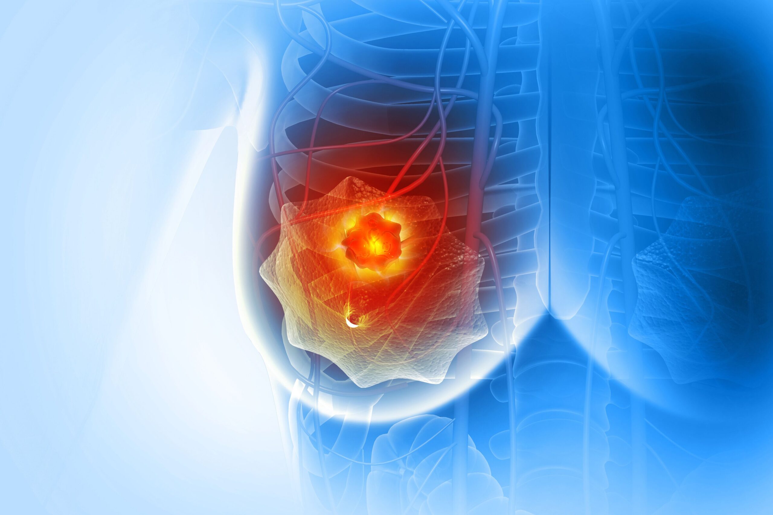 <![CDATA[New Study Evaluates Neoadjuvant HER3-Targeted ADC in Early Triple-Negative Breast Cancer]]>