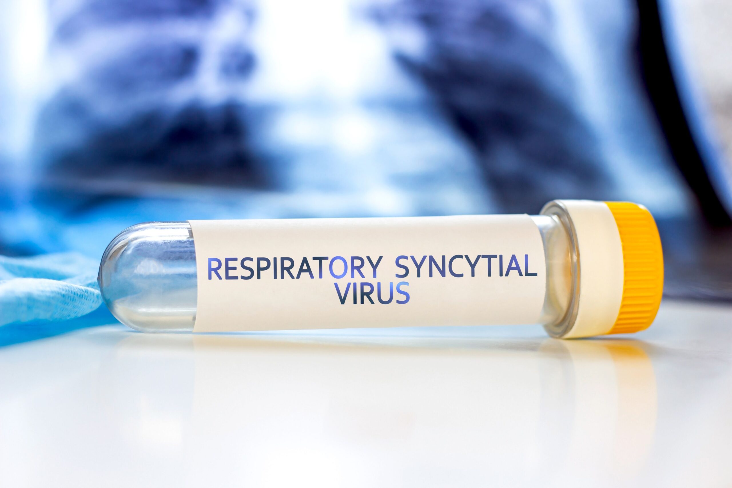 <![CDATA[How Rapid RSV Testing Shapes Clinical Decisions and Patient Outcomes]]>