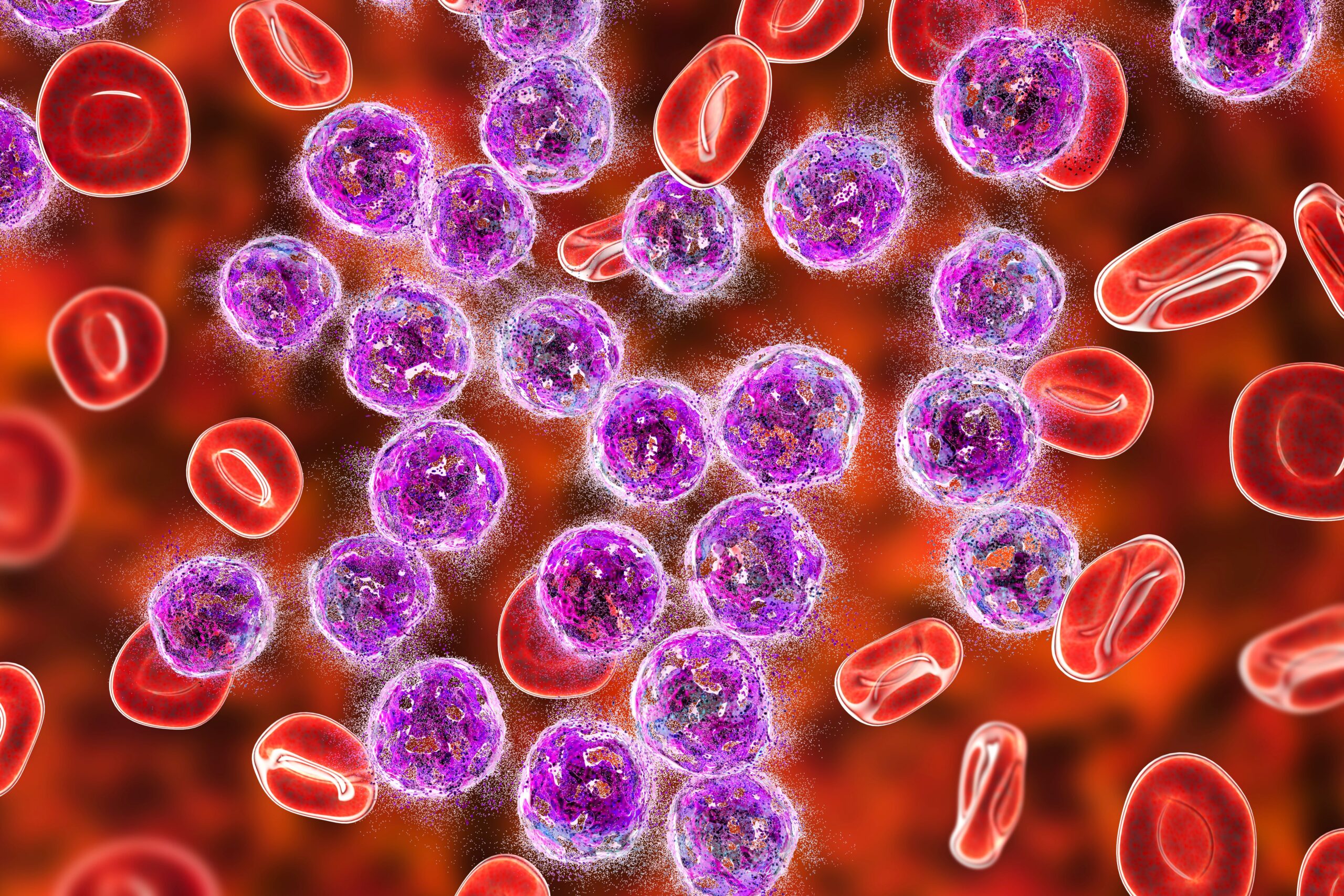 <![CDATA[FDA Grants Orphan Drug Status to Immunotherapy for Acute Myeloid Leukemia Treatment]]>