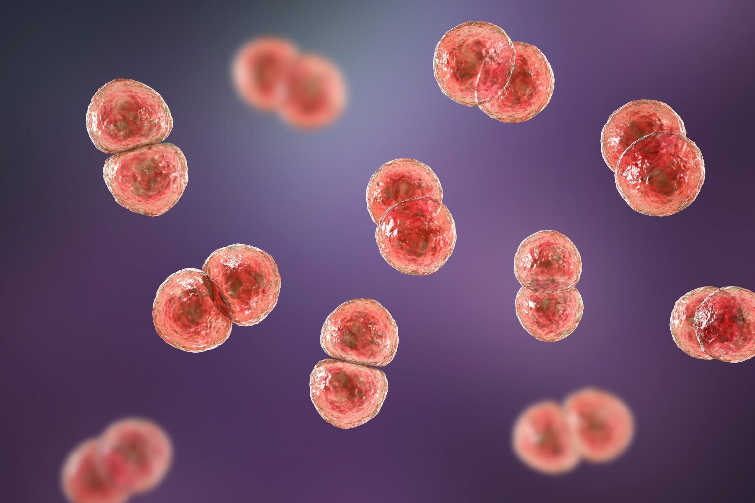 <![CDATA[Less Common Pneumococcal Serotypes Cause More Severe Community-Acquired Pneumonia]]>