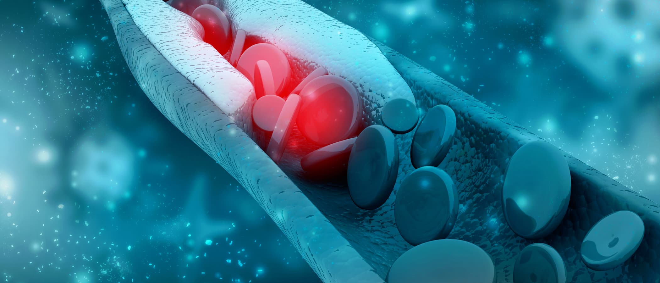 <![CDATA[Young Adults With High Cholesterol Often Refrain From Proper Treatment, Monitoring]]>