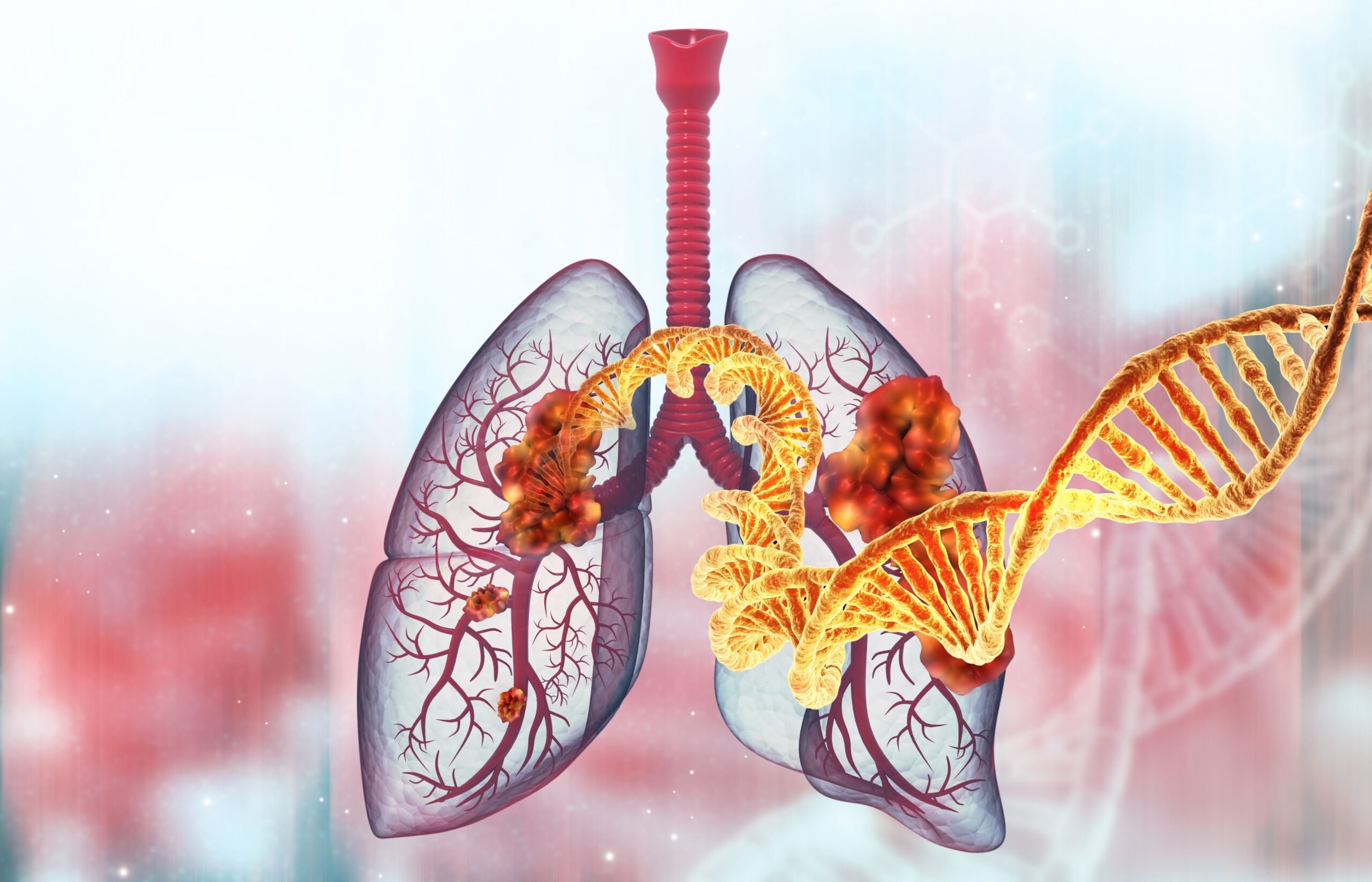 <![CDATA[Neladalkib Shows Durable Responses in Heavily Pretreated ALK-Positive Lung Cancer]]>