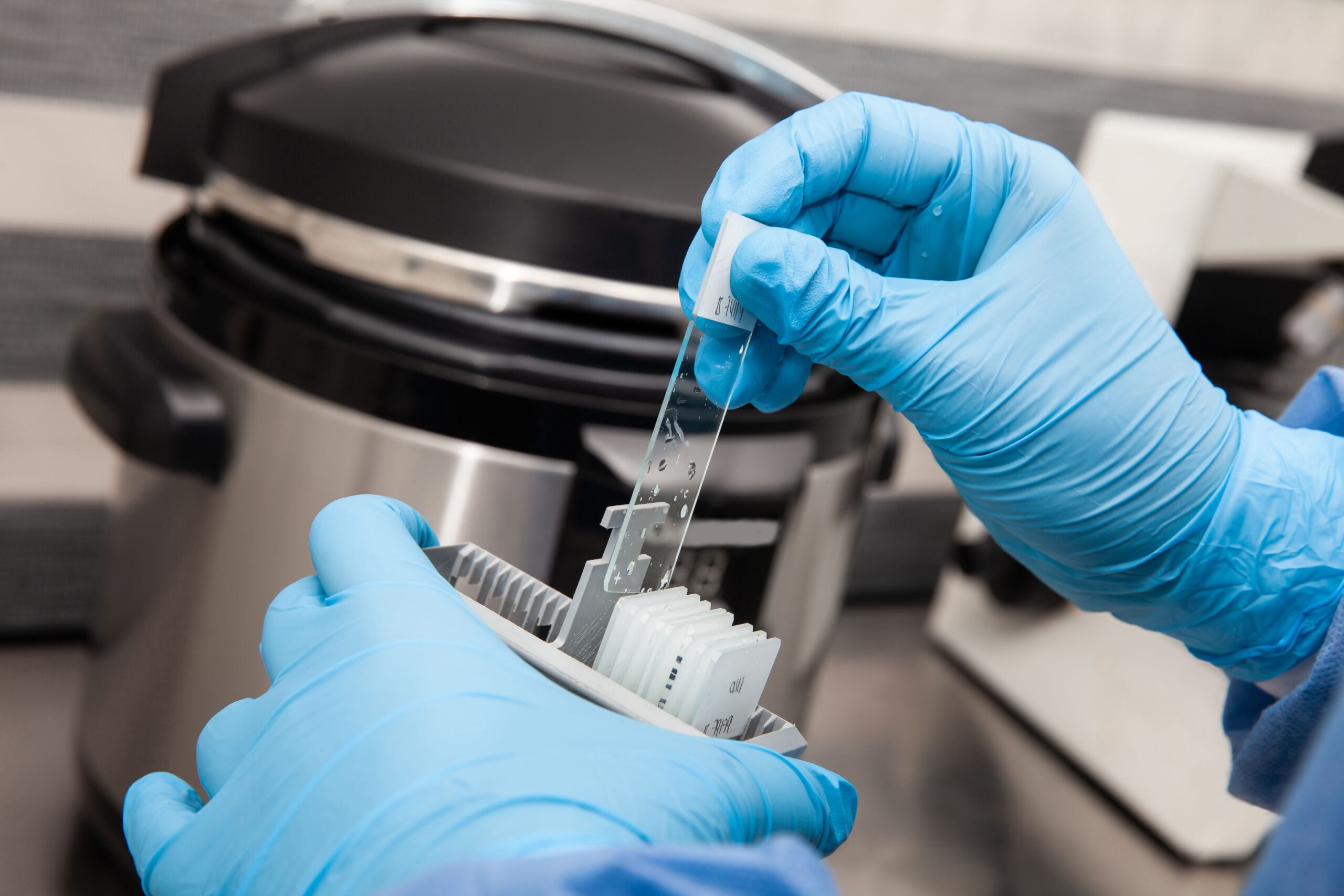 <![CDATA[New Findings Show Standard HER2 Assays Miss Key HER2-Low Cases]]>