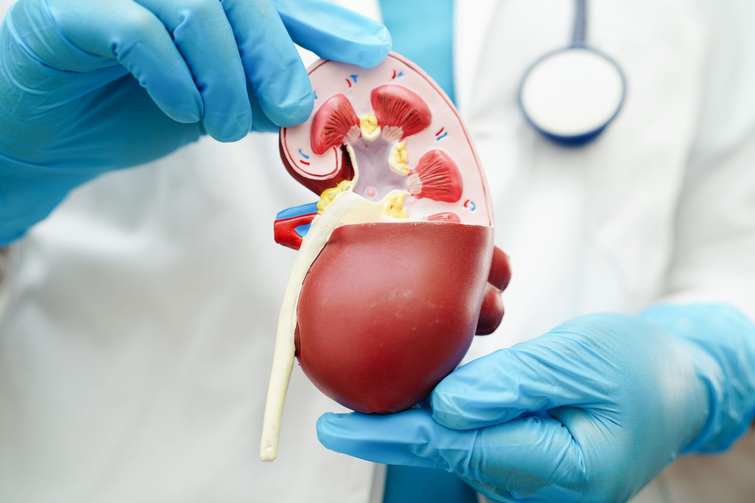 <![CDATA[Real-World Use of SGLT2 Inhibitors in CKD is Relatively Low, Study Finds]]>