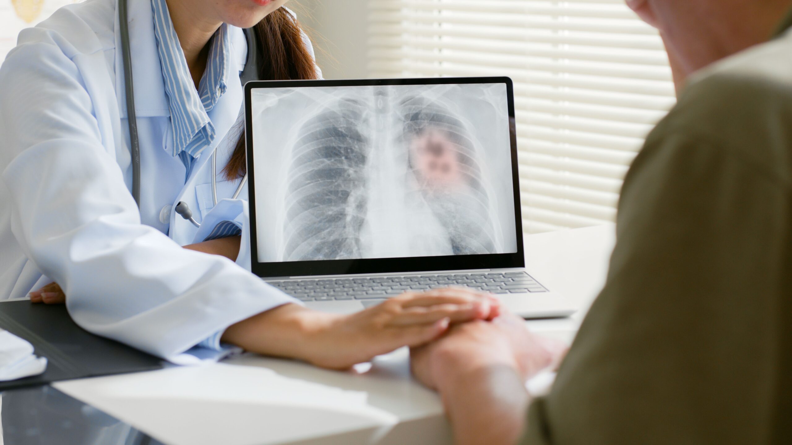 <![CDATA[Age-Based Lung Cancer Screening Could Dramatically Improve Early Detection]]>