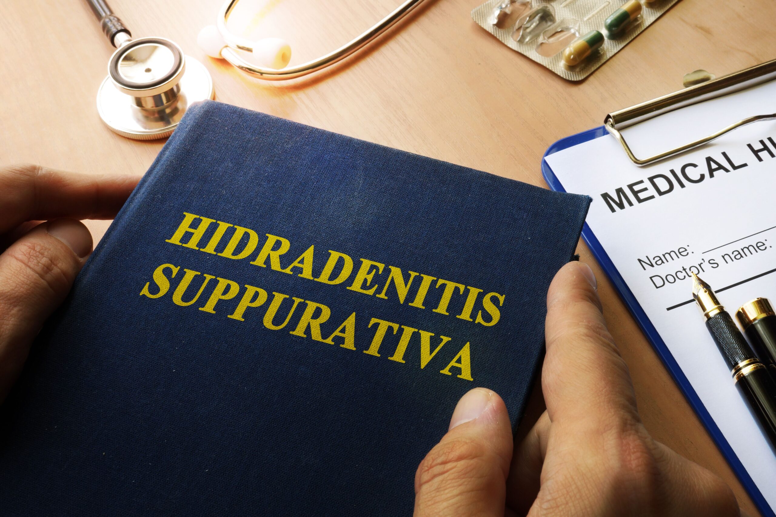 <![CDATA[Fibroblasts Identified as Key Drivers of Inflammation in Hidradenitis Suppurativa, New Study Shows]]>