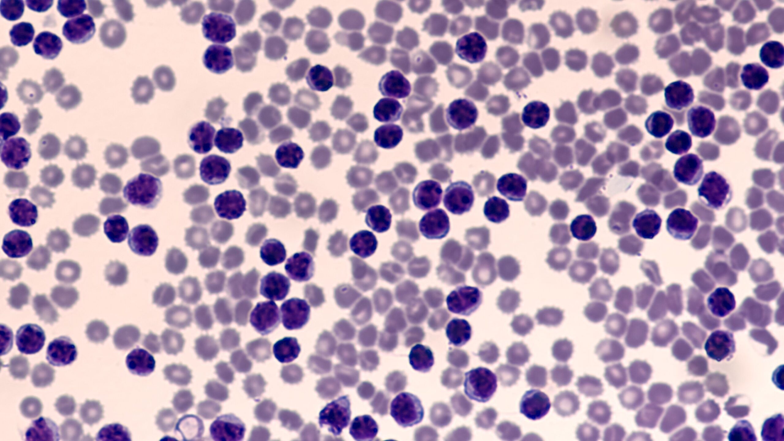<![CDATA[FDA Approves Pirtobrutinib for Relapsed or Refractory Chronic Lymphocytic Leukemia]]>