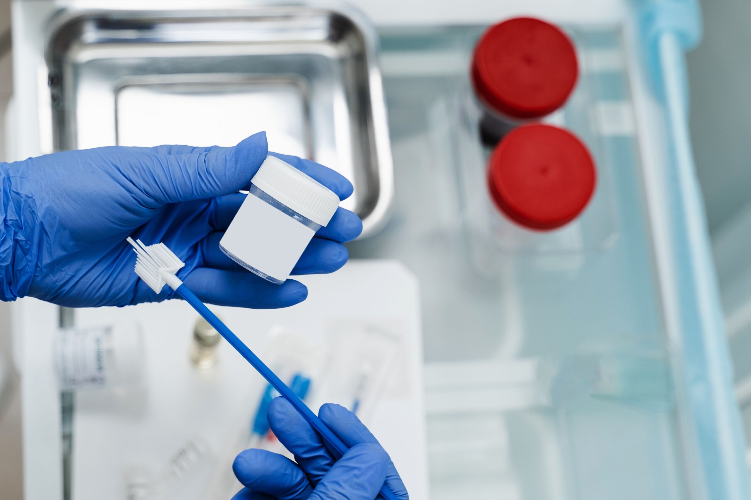 <![CDATA[American Cancer Society Updates Cervical Cancer Screening Guidelines to Include Self-Collection for HPV Testing]]>