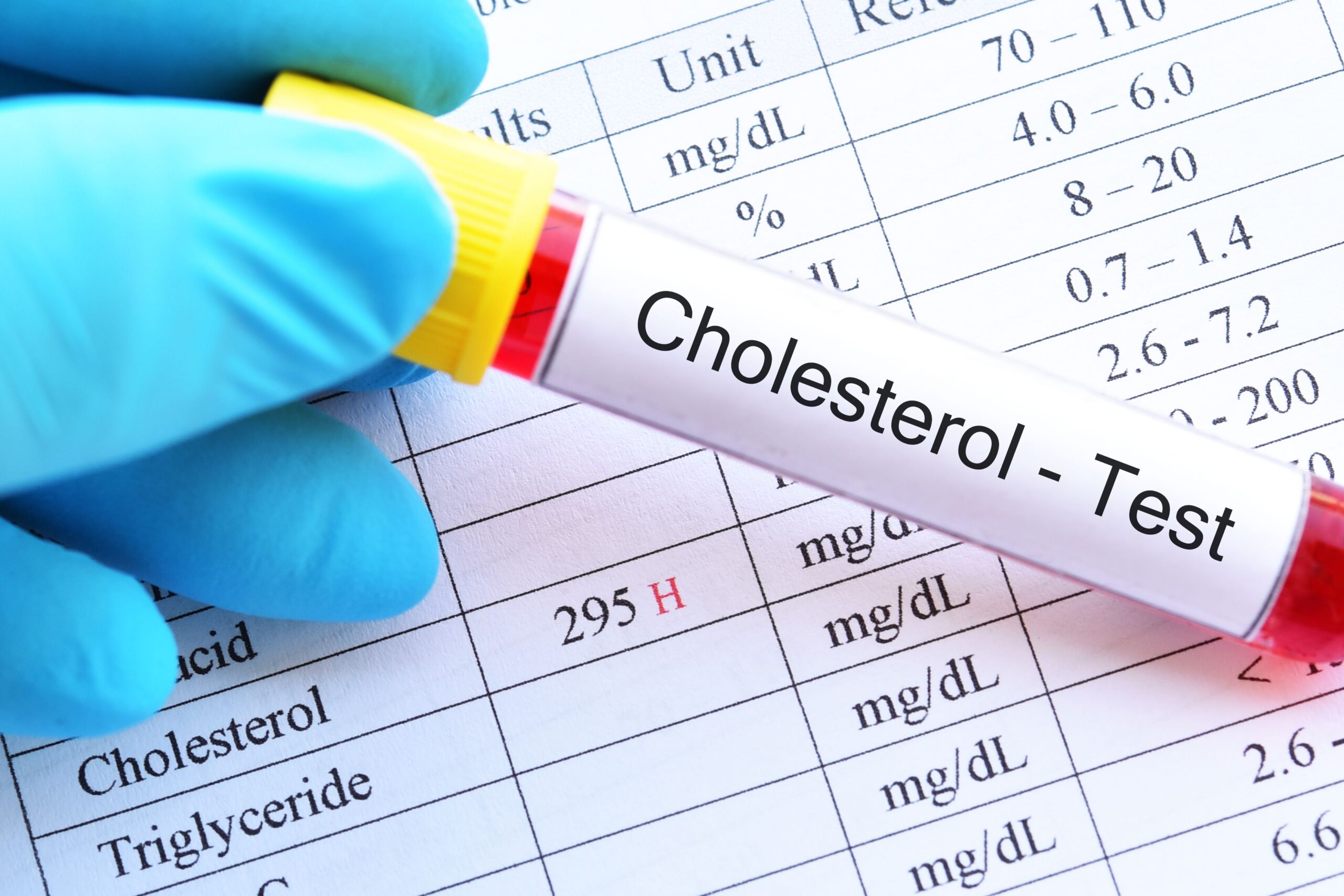 <![CDATA[Low Cholesterol Levels Linked to More Active Crohn Disease, Study Finds]]>