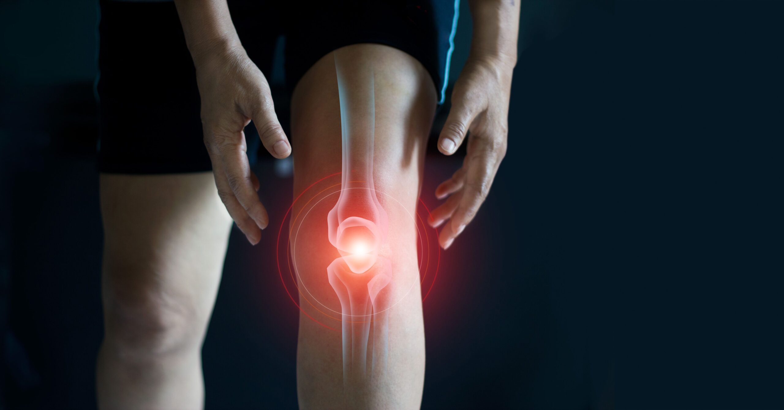 <![CDATA[Once-Weekly Retatrutide Reduces Weight and Knee Pain in Patients With Obesity and Osteoarthritis]]>