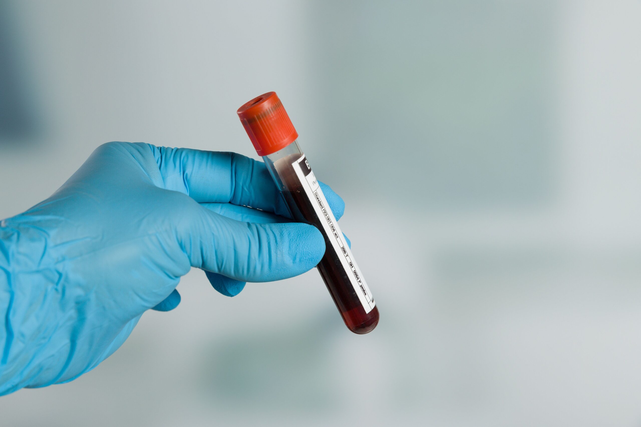 <![CDATA[Test Detects Single Circulating Tumor Cells Using Infrared Imaging ]]>