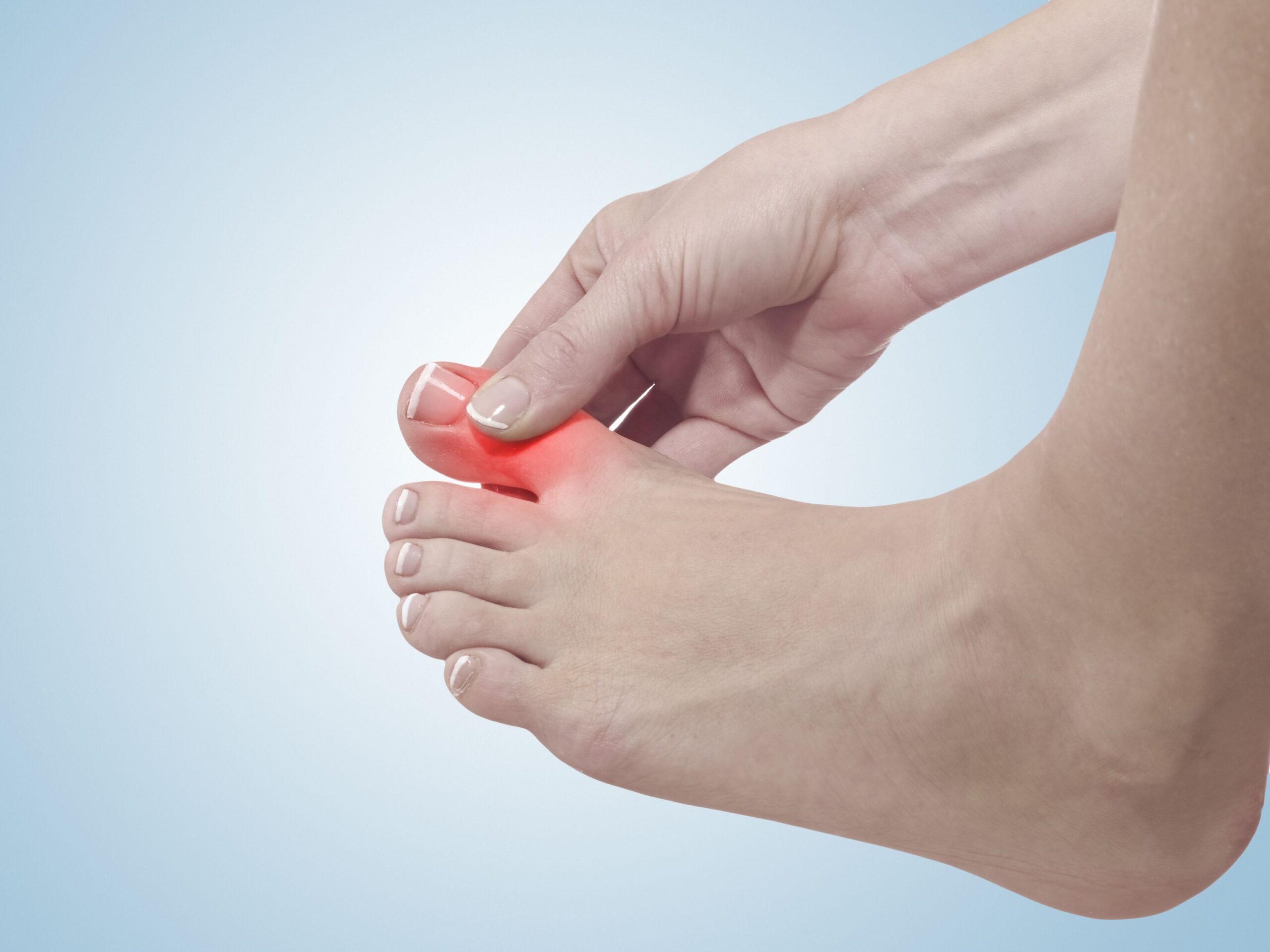 <![CDATA[ASN 2025 Kidney Week: Research Demonstrates Associations Between CKD and Gout]]>