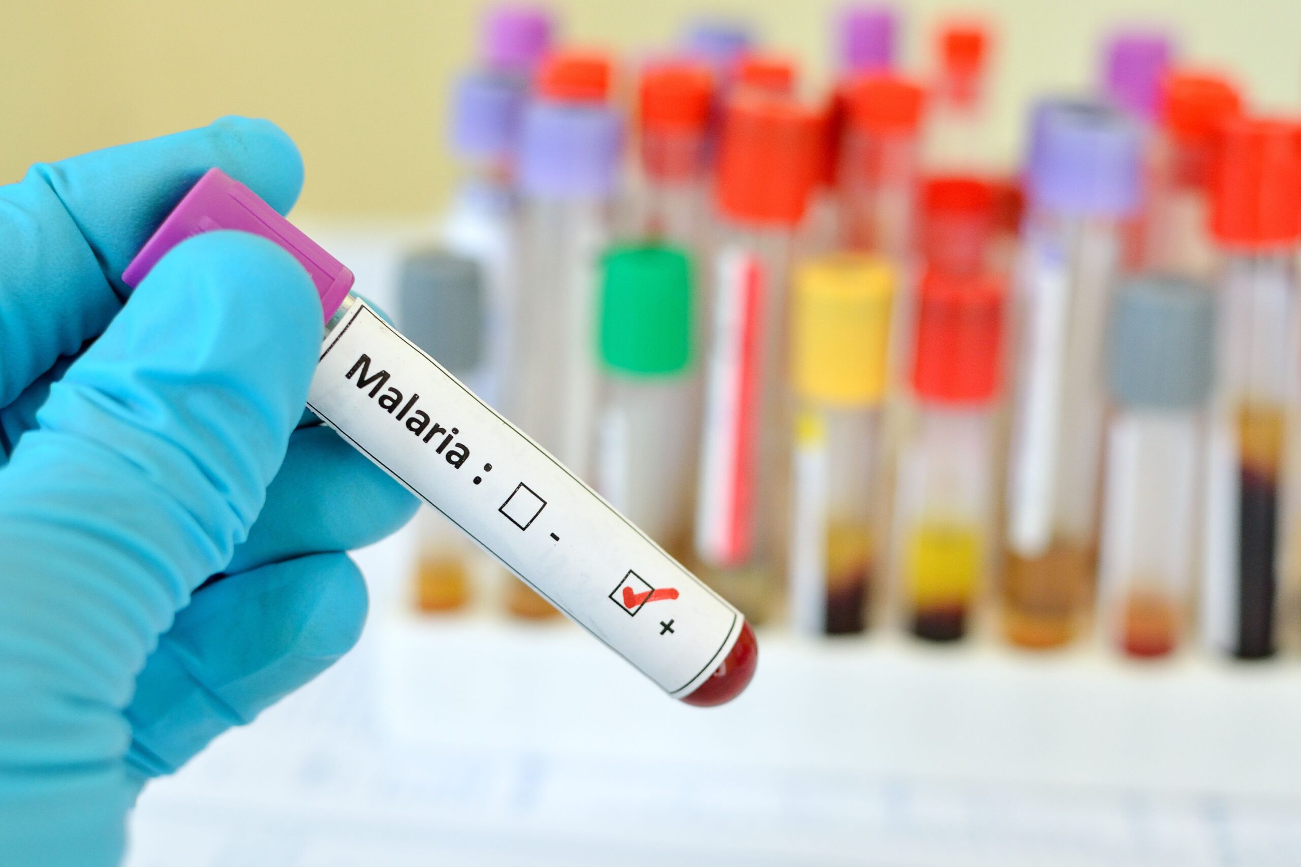 <![CDATA[Experimental Multistage Malaria Vaccine Demonstrates Promising Protection in Early Trial]]>