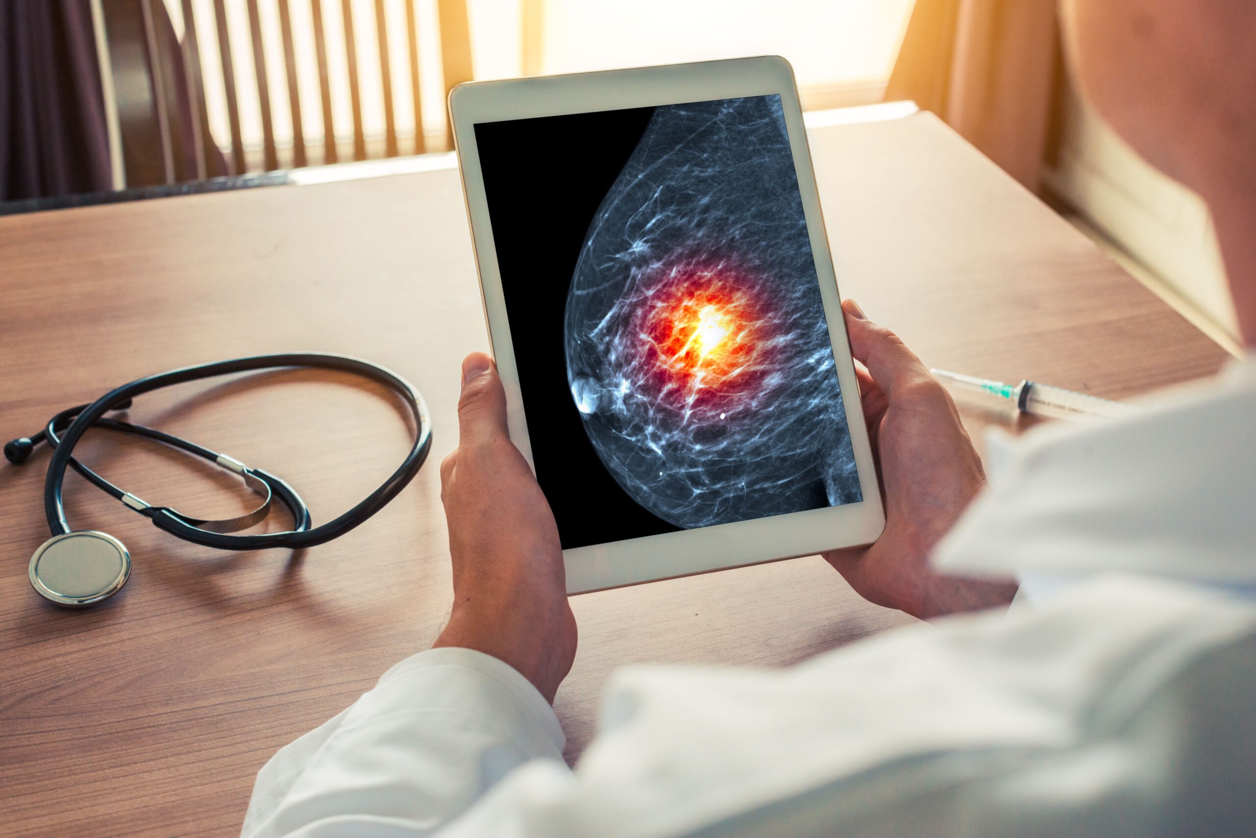 <![CDATA[FLEX Study Data Highlight Role of Genomic Testing in Guiding Early-Stage Breast Cancer Treatment]]>