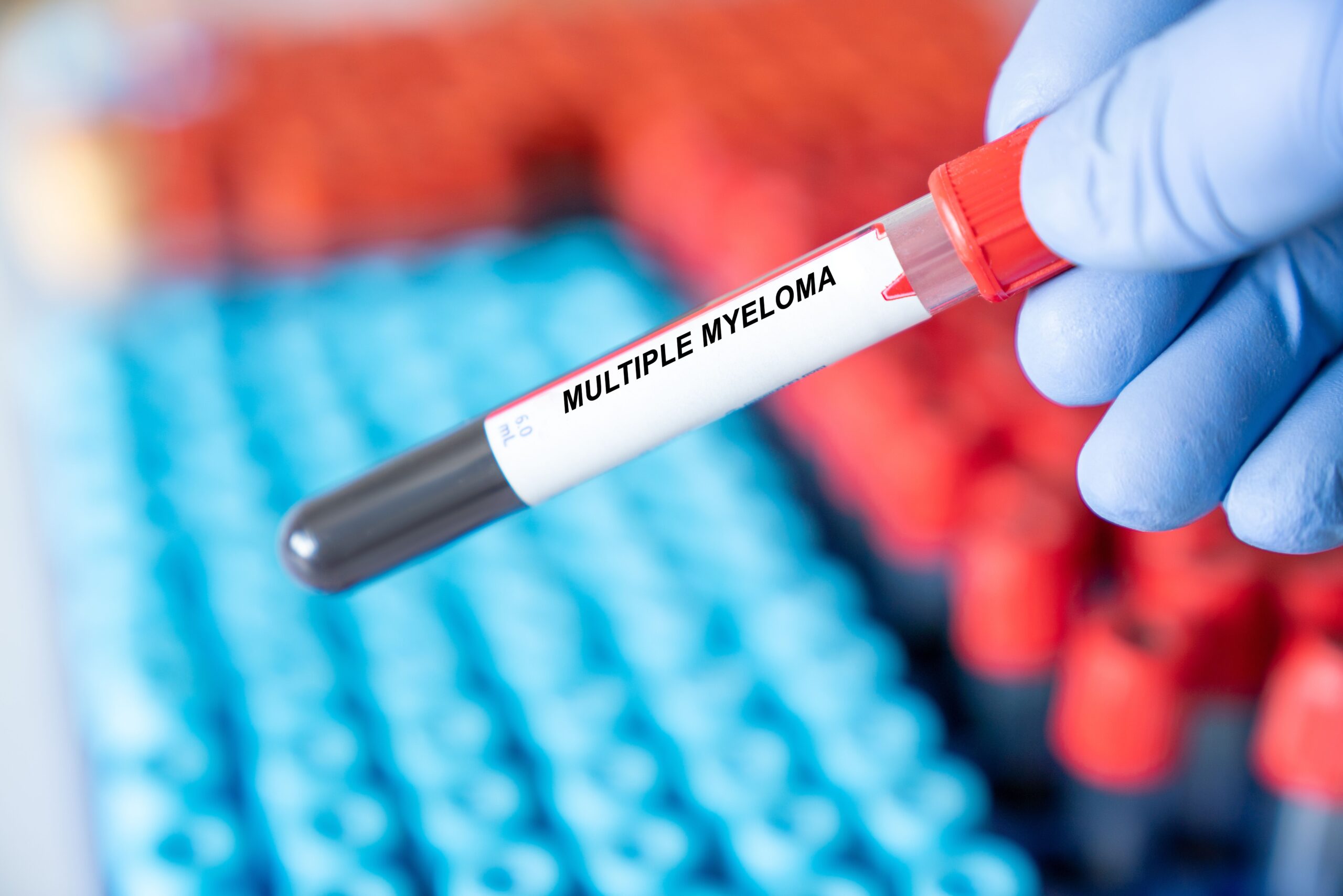 <![CDATA[Dual-Antibody Approach Advances Treatment of Extramedullary Multiple Myeloma]]>